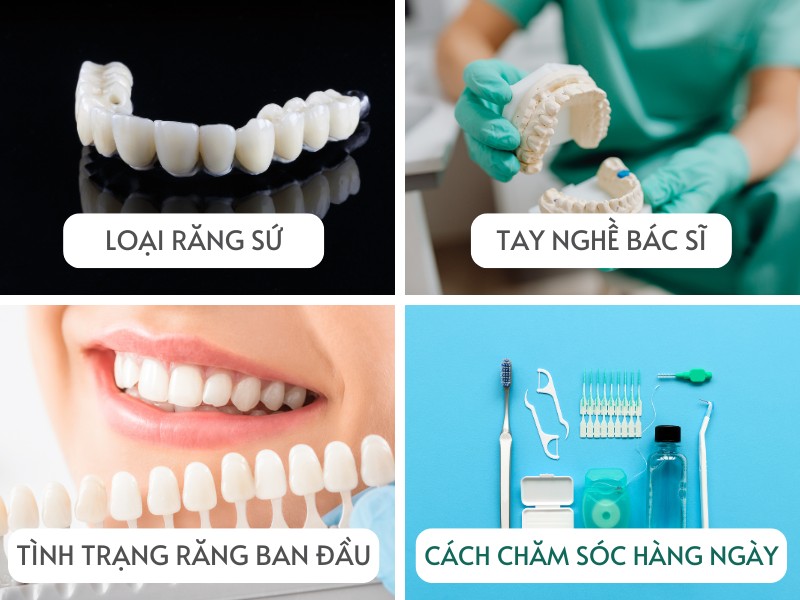 Bọc răng sứ bao lâu thì phải làm lại tùy thuộc vào loại răng sứ bạn chọn