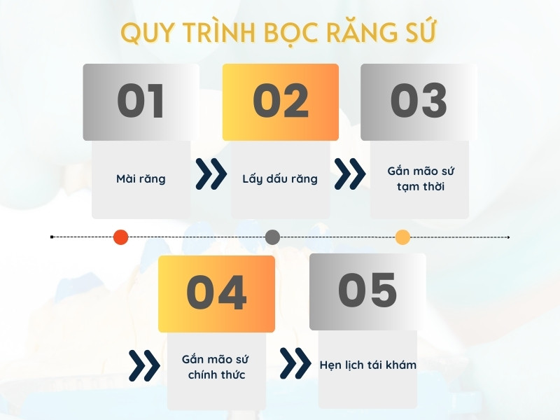 Lấy tủy và bọc răng sứ