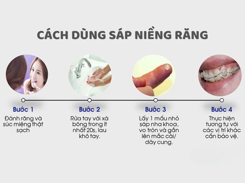 Cách dùng sáp niềng răng hiệu quả