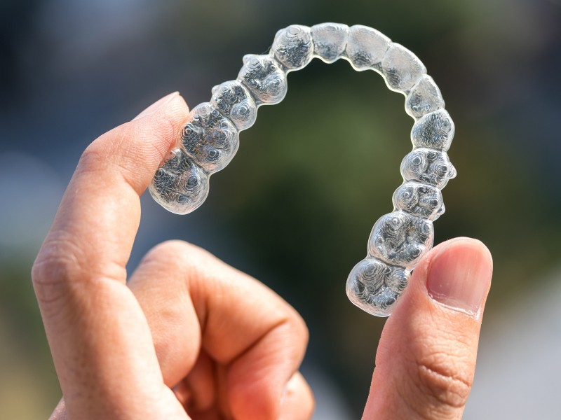 Niềng răng Invisalign có tốt không