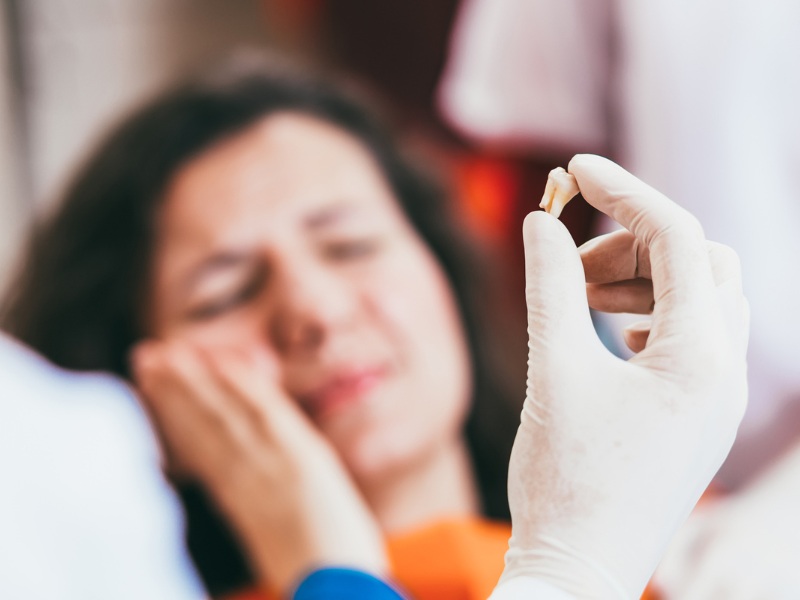 nhổ răng khôn kiêng ăn gì