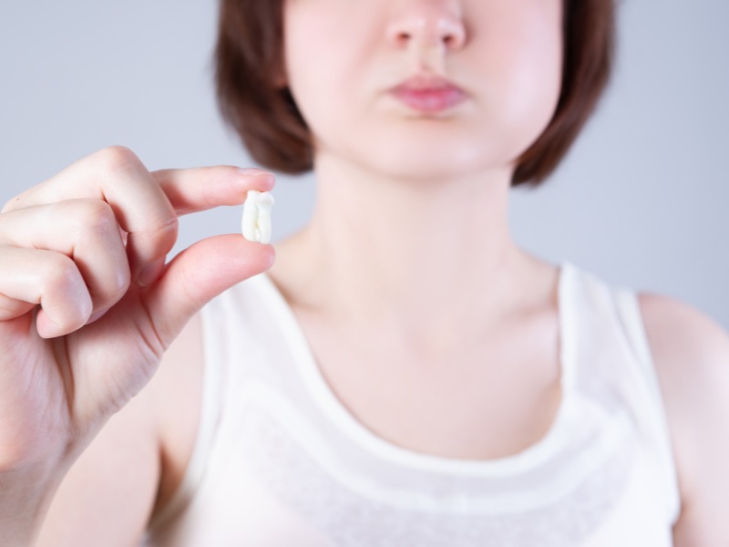 Sưng mặt do nhổ răng khôn là hiện tượng thường gặp