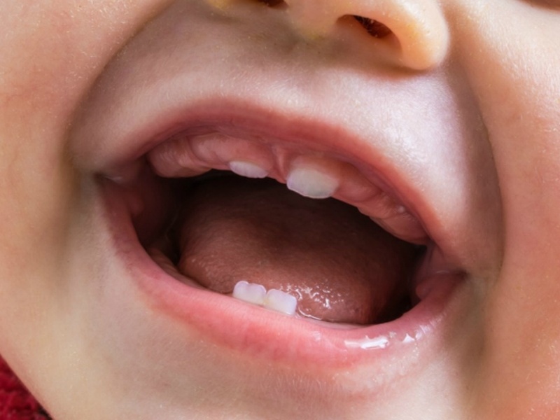 Trẻ bắt đầu mọc răng sữa đầu tiên từ 6-7 tháng tuổi